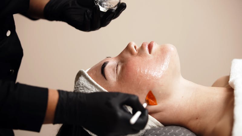 Patient getting a chemical peel