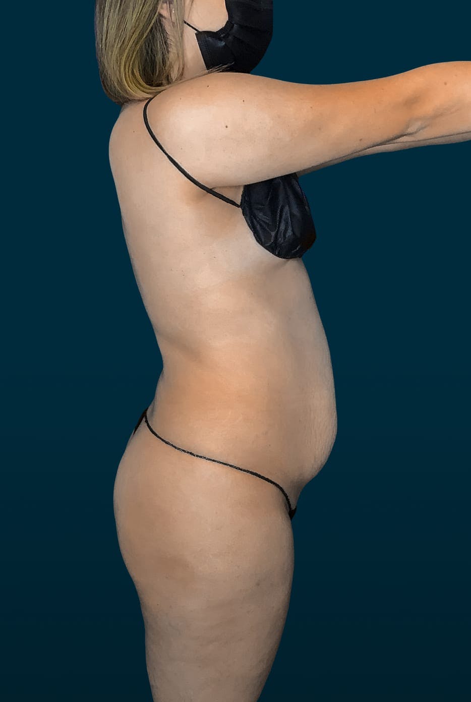 Patient before media