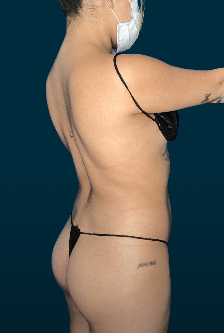 Patient before media