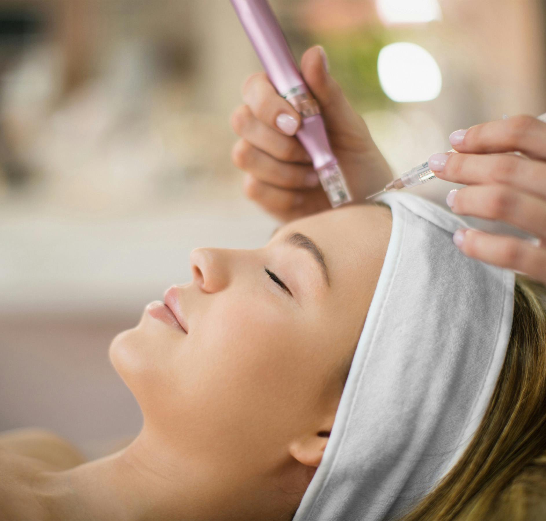 microneedling forehead