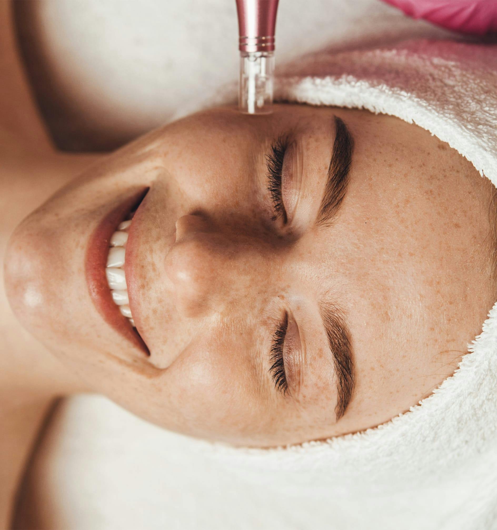 woman receiving microneedling