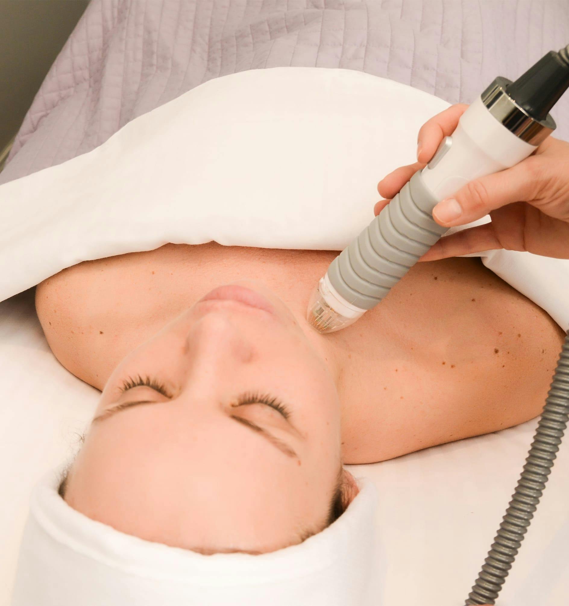 woman getting laser treatment