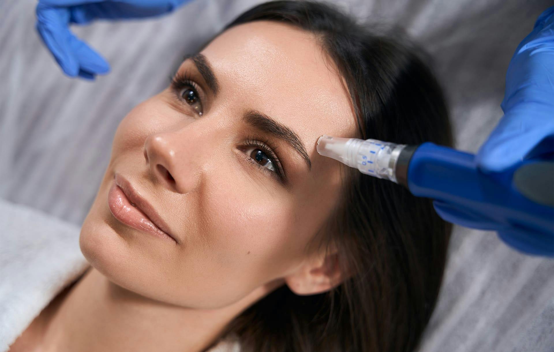 woman receiving microneedling