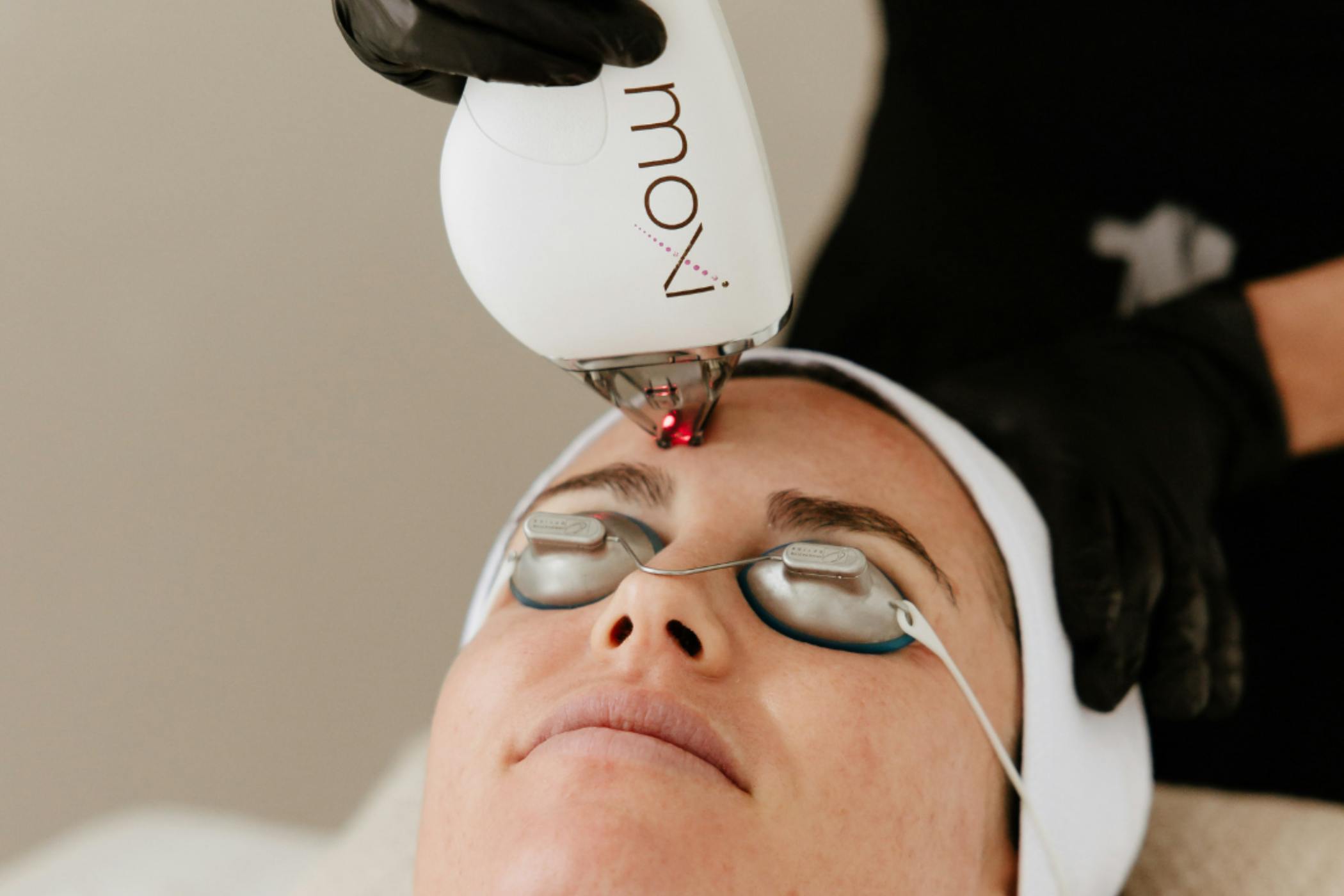 MOXI laser