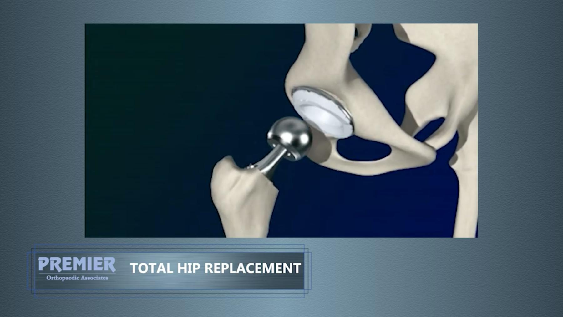 Premier Orthopaedic Associates