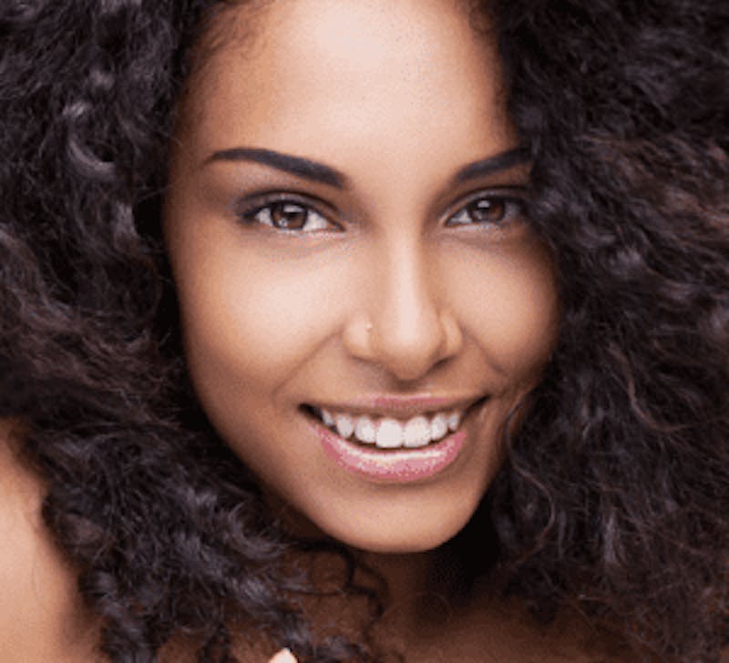 african-american-rhinoplasty african-american-rhinoplasty