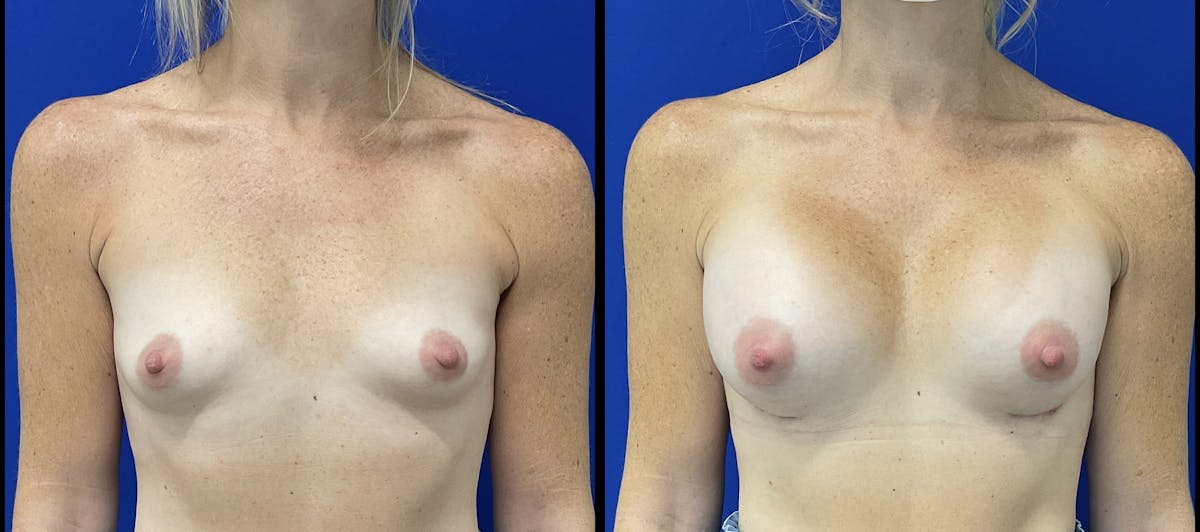 Her Body, Her Soul Before & After Gallery - Patient 246494 - Image 2