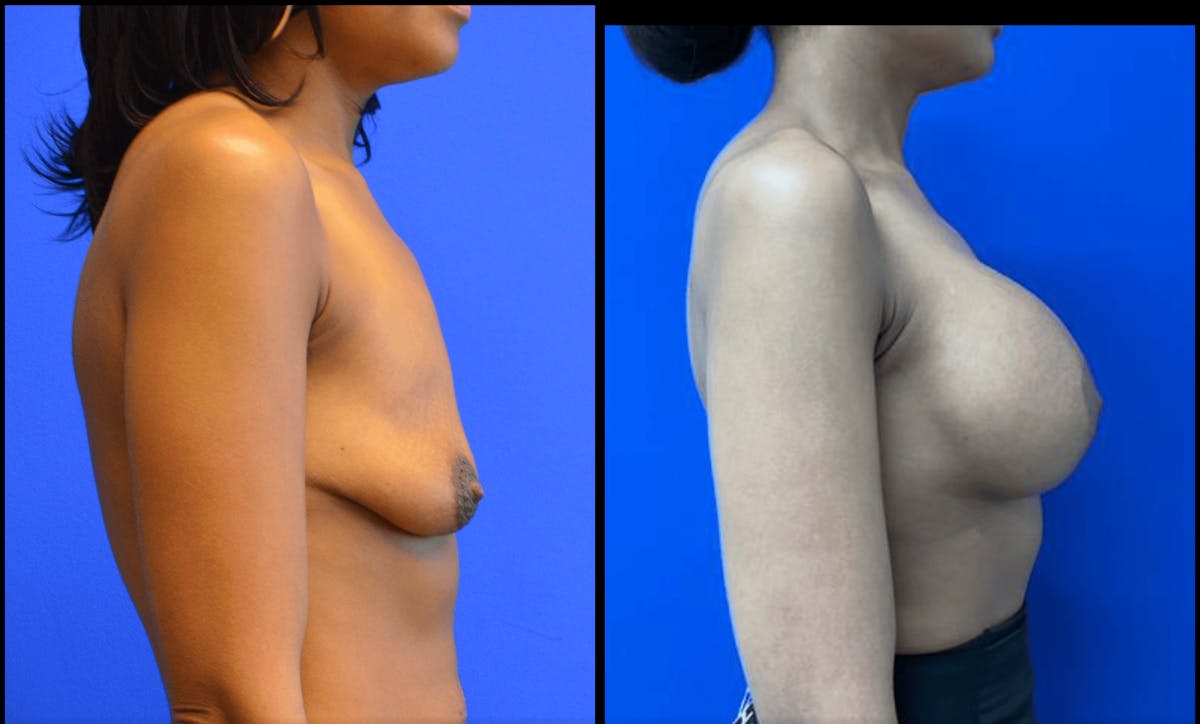 Her Body, Her Soul Before & After Gallery - Patient 166683 - Image 5