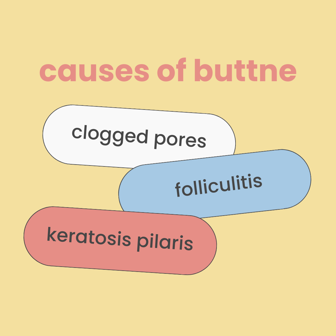 What is "buttne"?