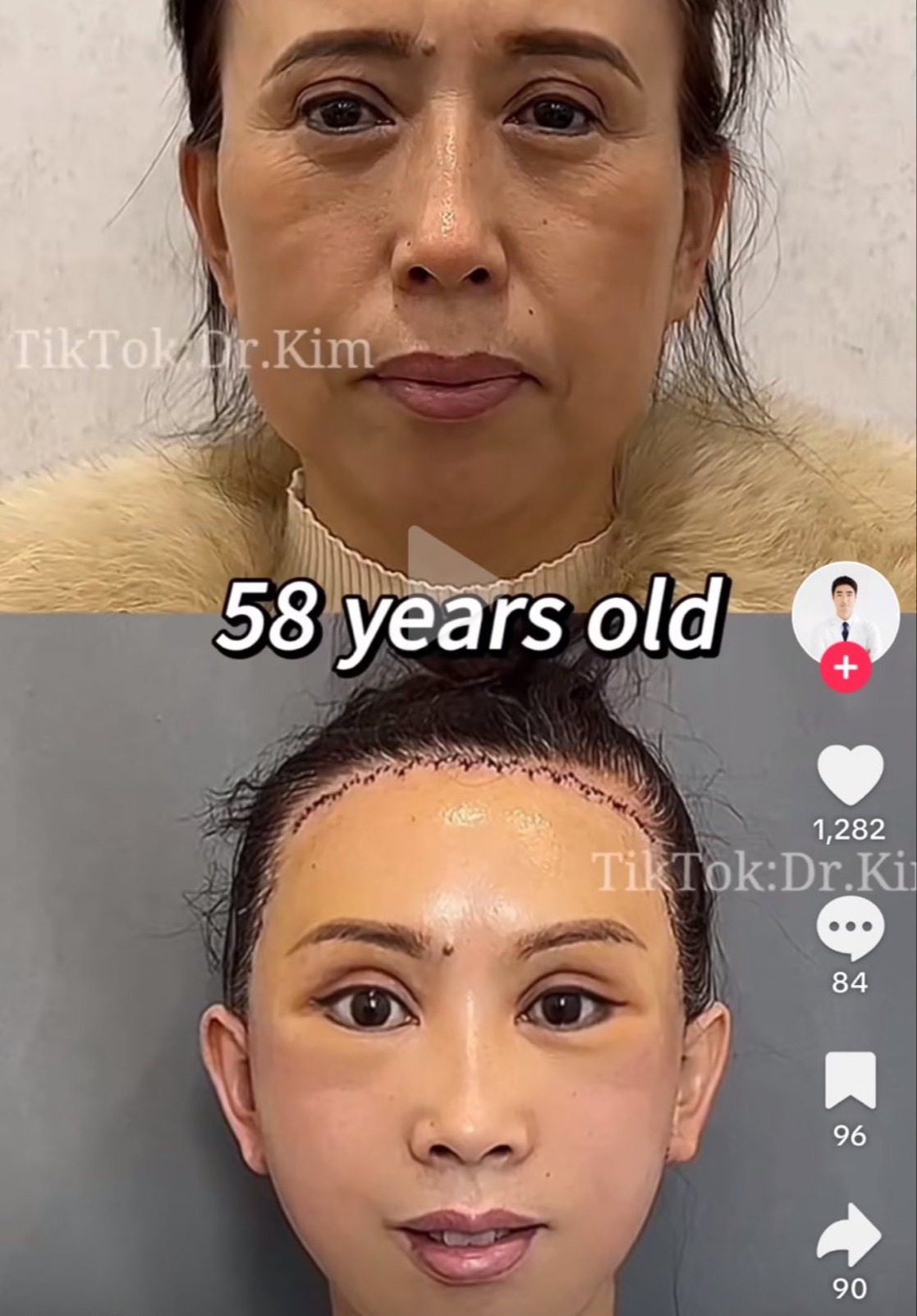 Not To Be A Hater But Im Tired Of Plastic Surgeons | Evie Magazine