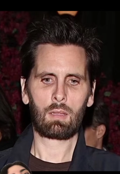 &ldquo;Ozempic Face&rdquo; Has Taken Over Hollywood, According To Plastic Surgeons