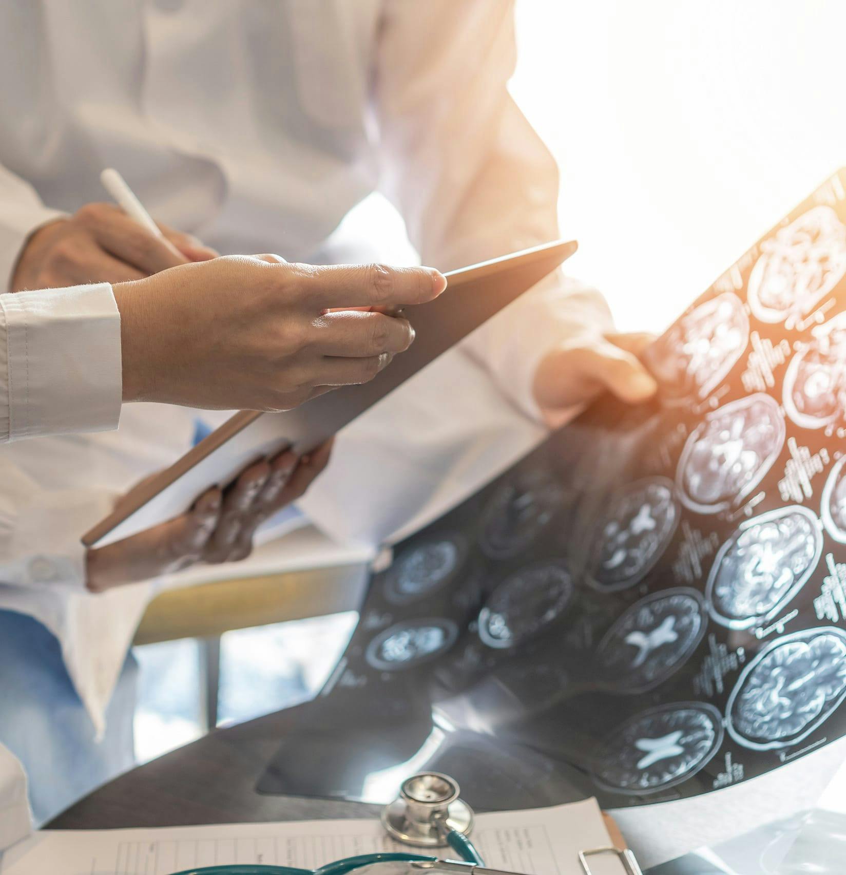 Doctor looking at a brain scan