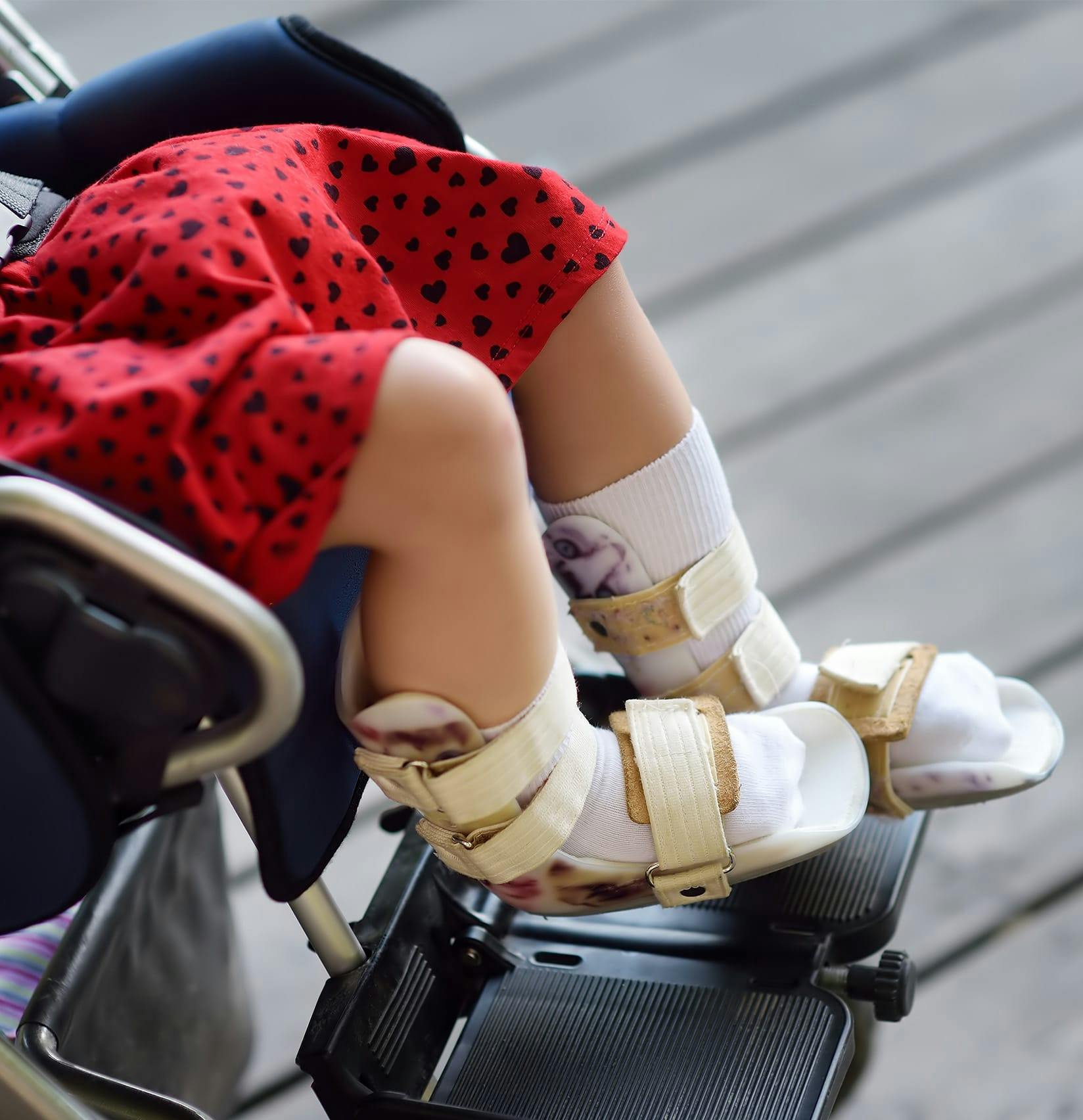 child in a wheelchair with braces on her feet