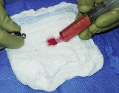 supernatant oil process in texas supernatant oil process in texas