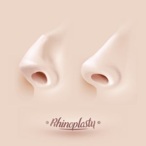 How a Functional Rhinoplasty Could Revolutionize Your Life