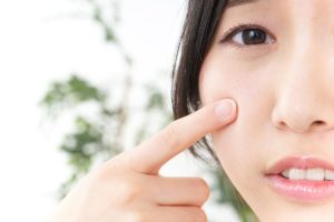 Scars happen, but here's what you can do to help them heal! — Central Wagga  Medical | Cosmetic Treatments and General Practice