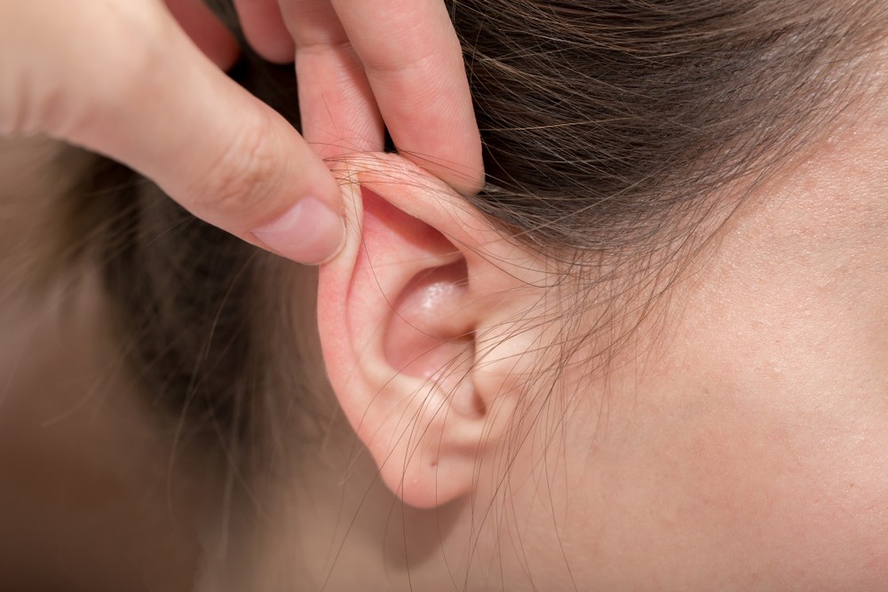 Why is otoplasty called Ear Pinning Austin TX