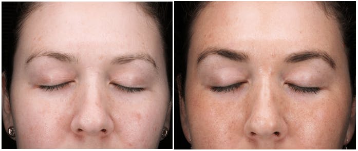 Claire Spera before and after RevitaLash and RevitaBrow