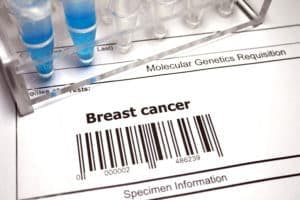 Genetic research abstract - Breast cancer