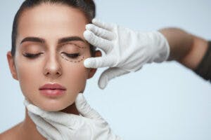 eyelid lift