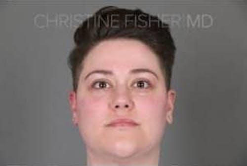 Before procedure image for Botox® & Dysport®