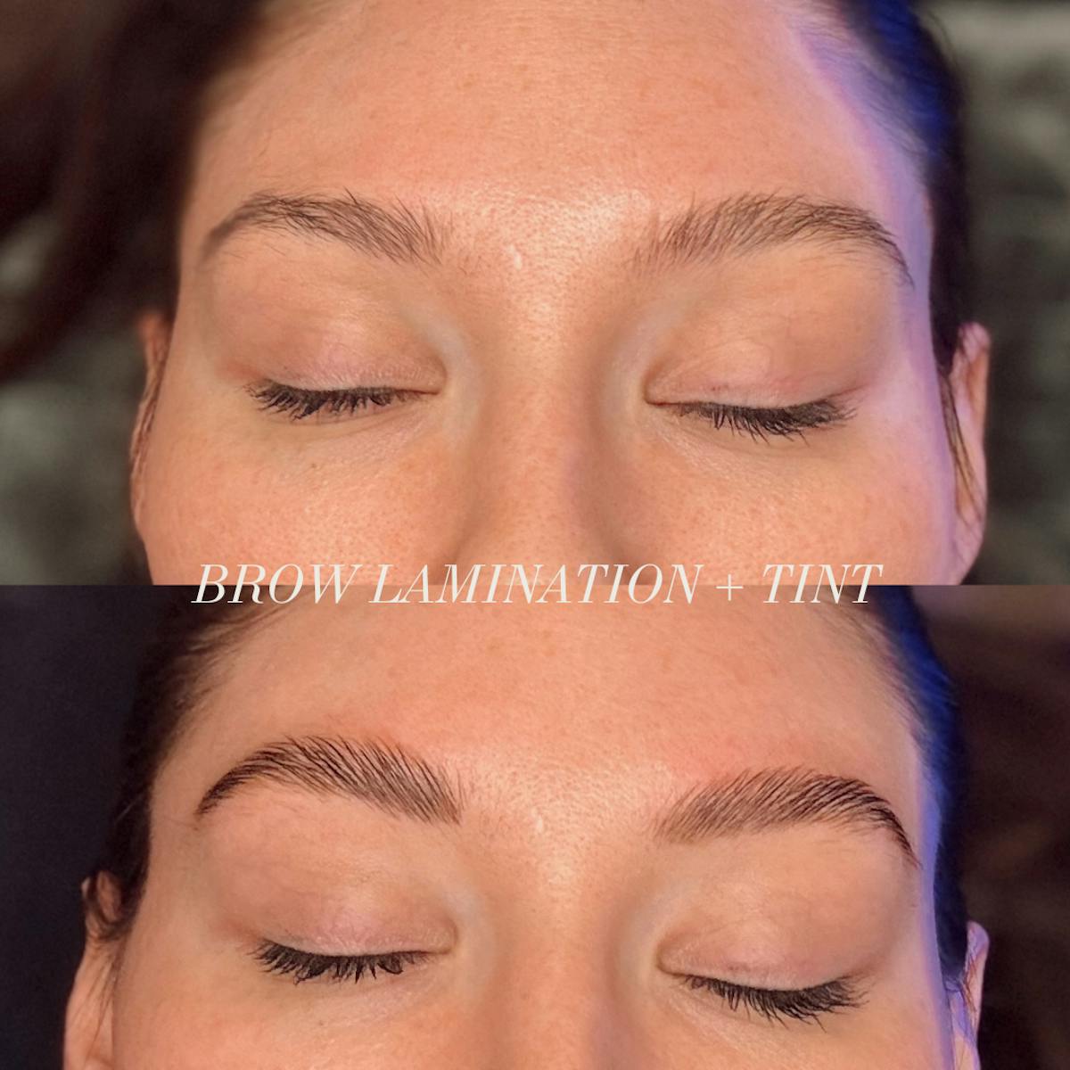 Brows Before & After Gallery - Patient 750641 - Image 1