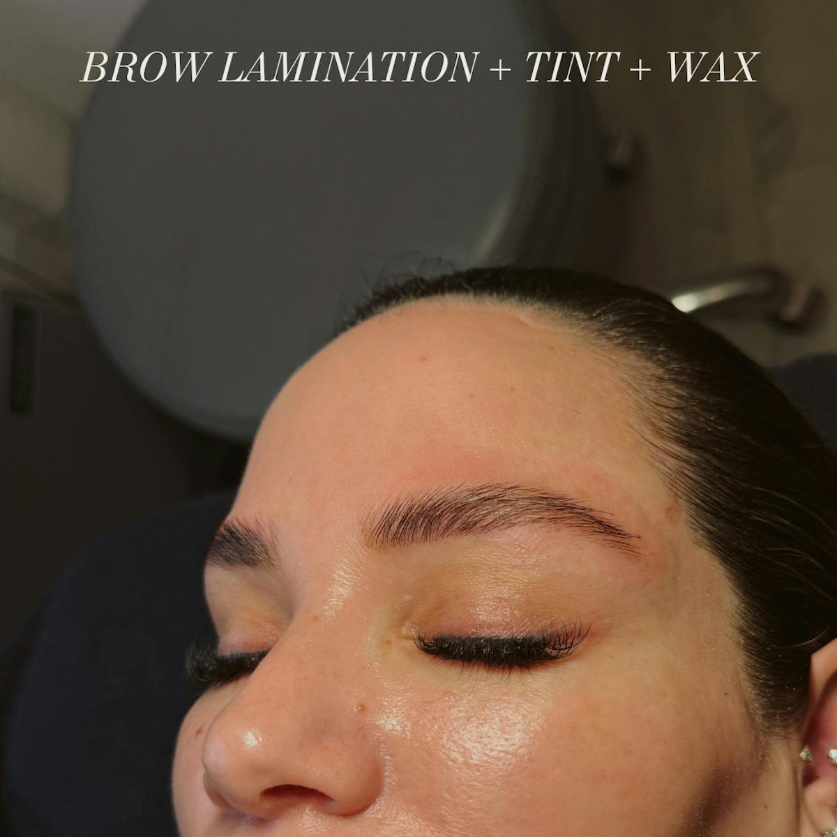 Brows Before & After Gallery - Patient 370304 - Image 1