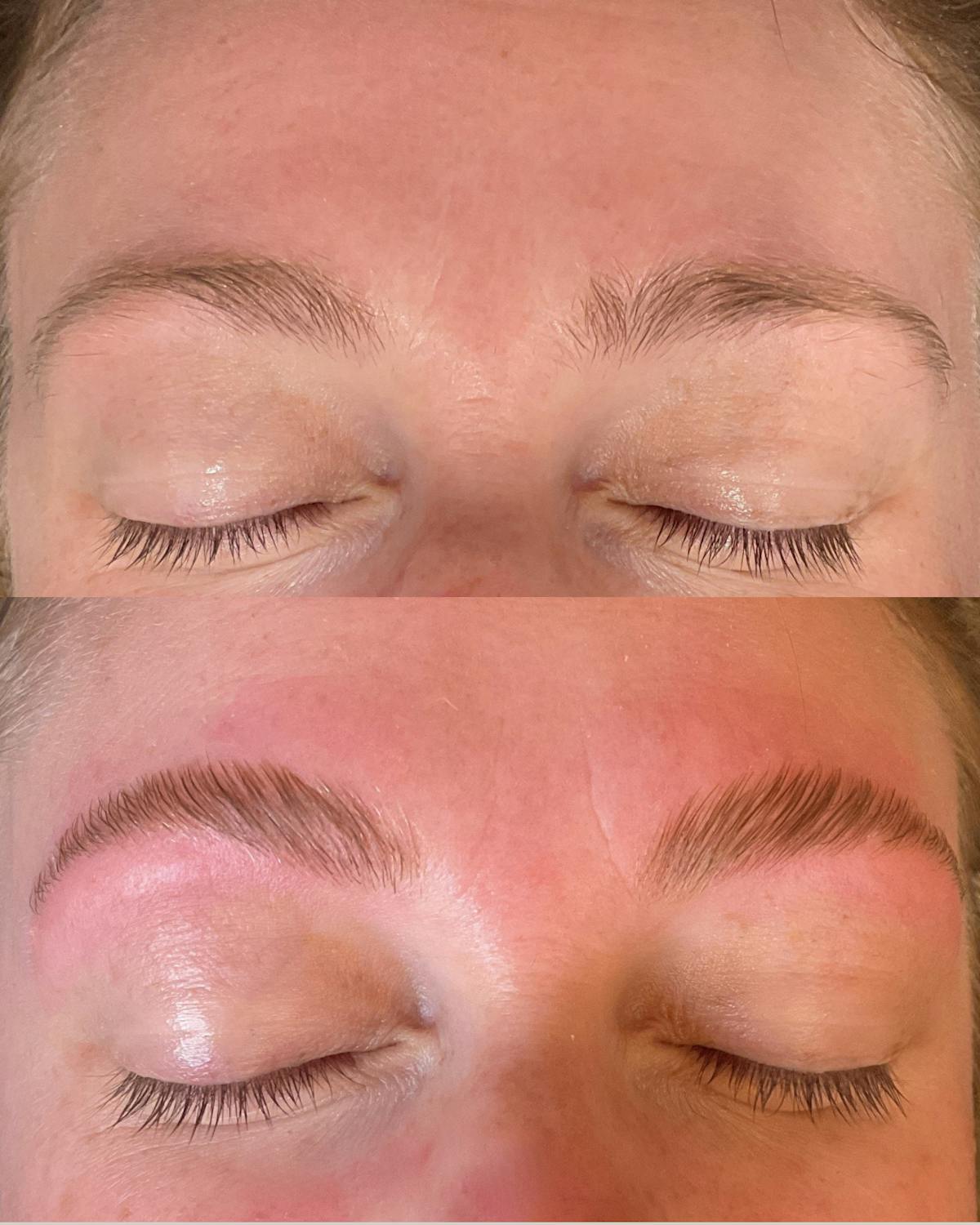 Brows Before & After Gallery - Patient 814677 - Image 1