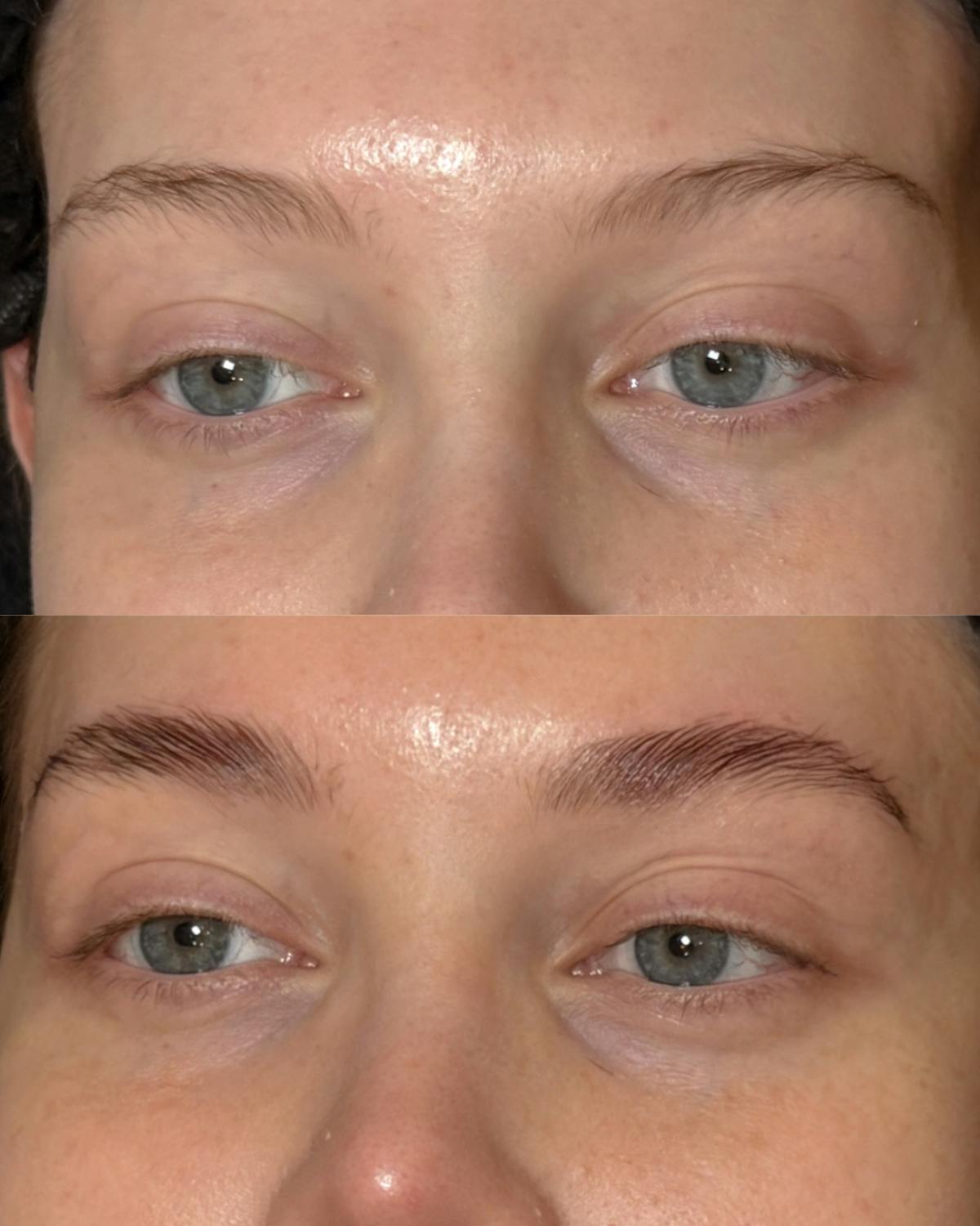 Brows Before & After Gallery - Patient 156824 - Image 1