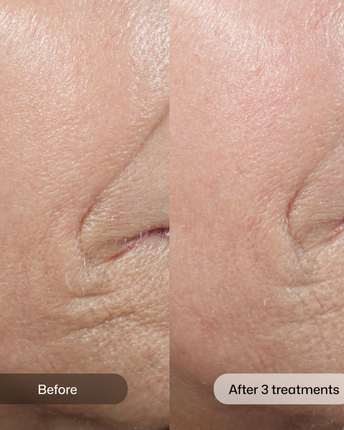 D.E.J BIOSTIM Before & After Gallery - Patient 341698 - Image 1