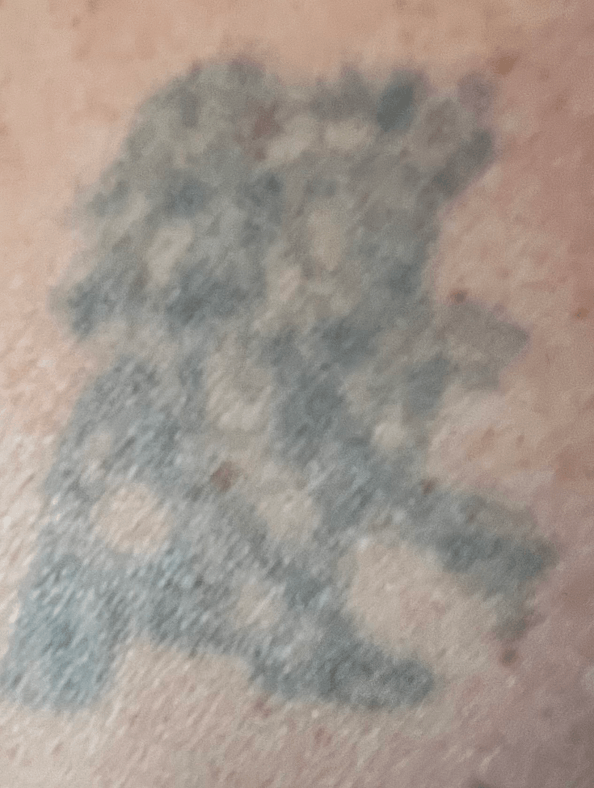 Tatu