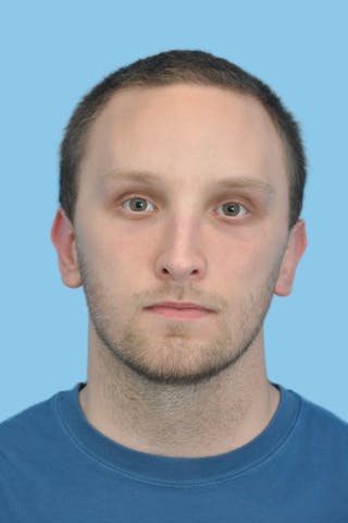 Rhinoplasty Before & After Gallery - Patient 115720 - Image 2