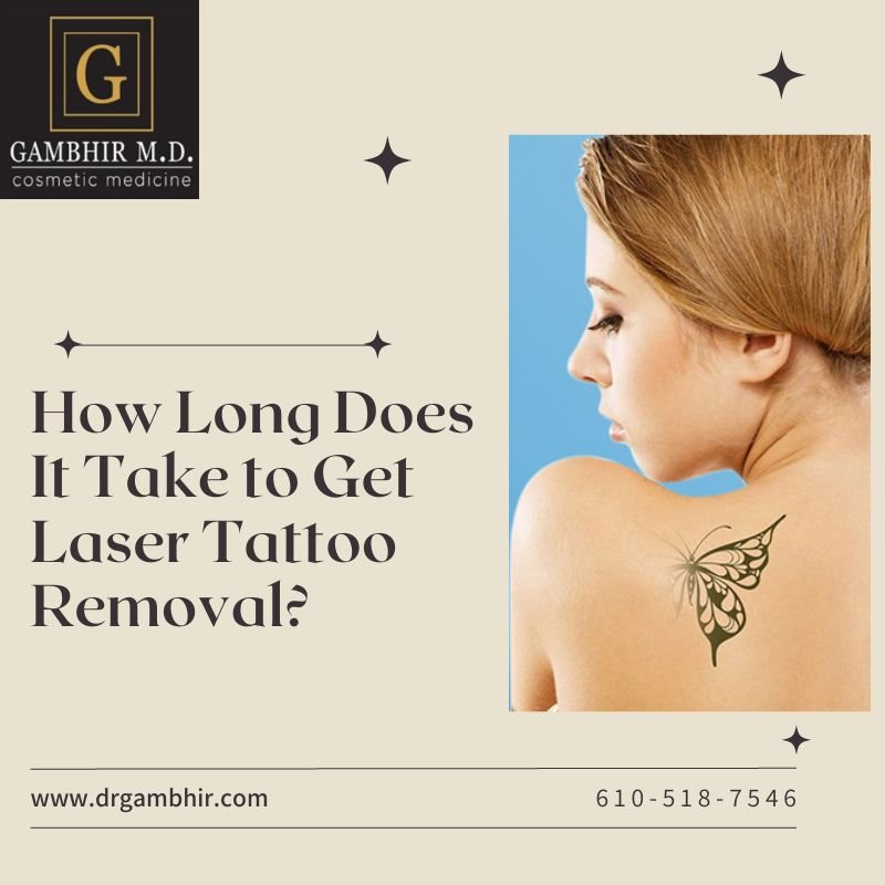 How to Start a Laser Tattoo Removal Business | OppGen