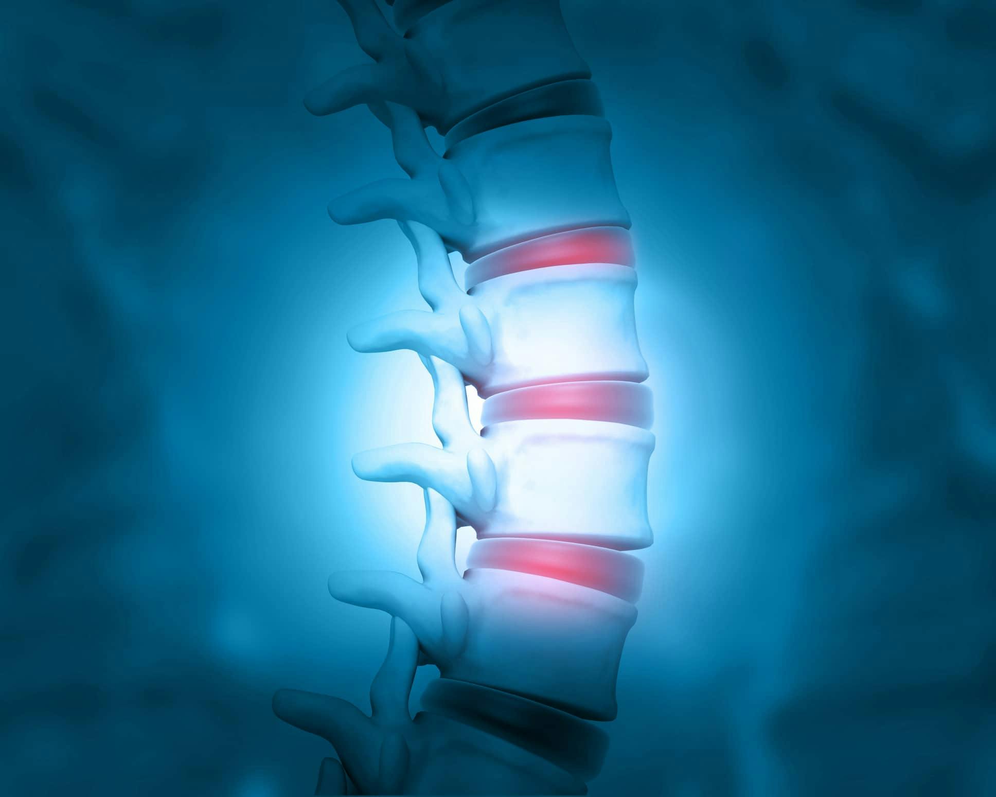 3d image of spine