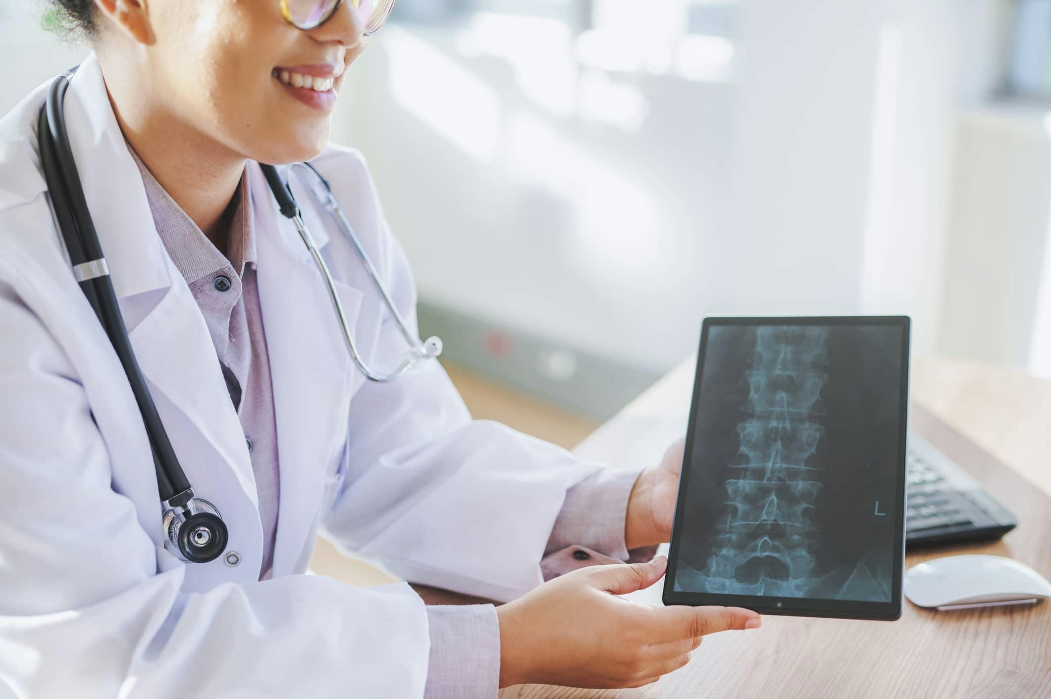 Doctor smiling and holding spine x-rays