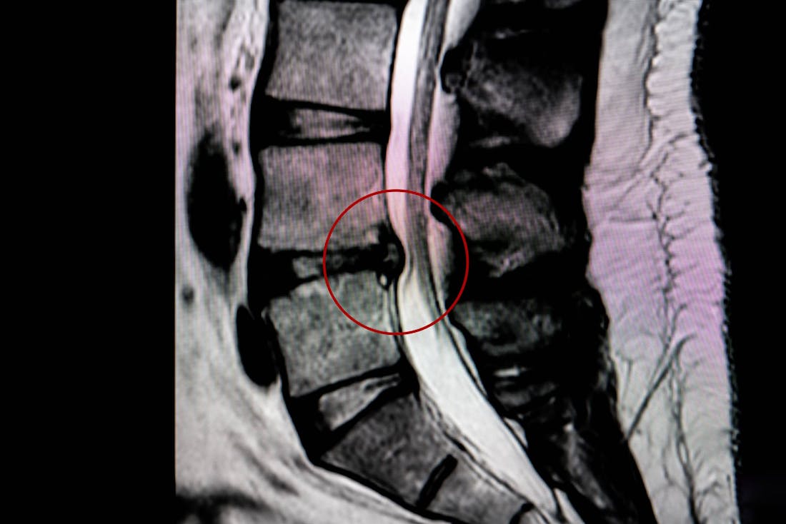 X-ray image of the spine