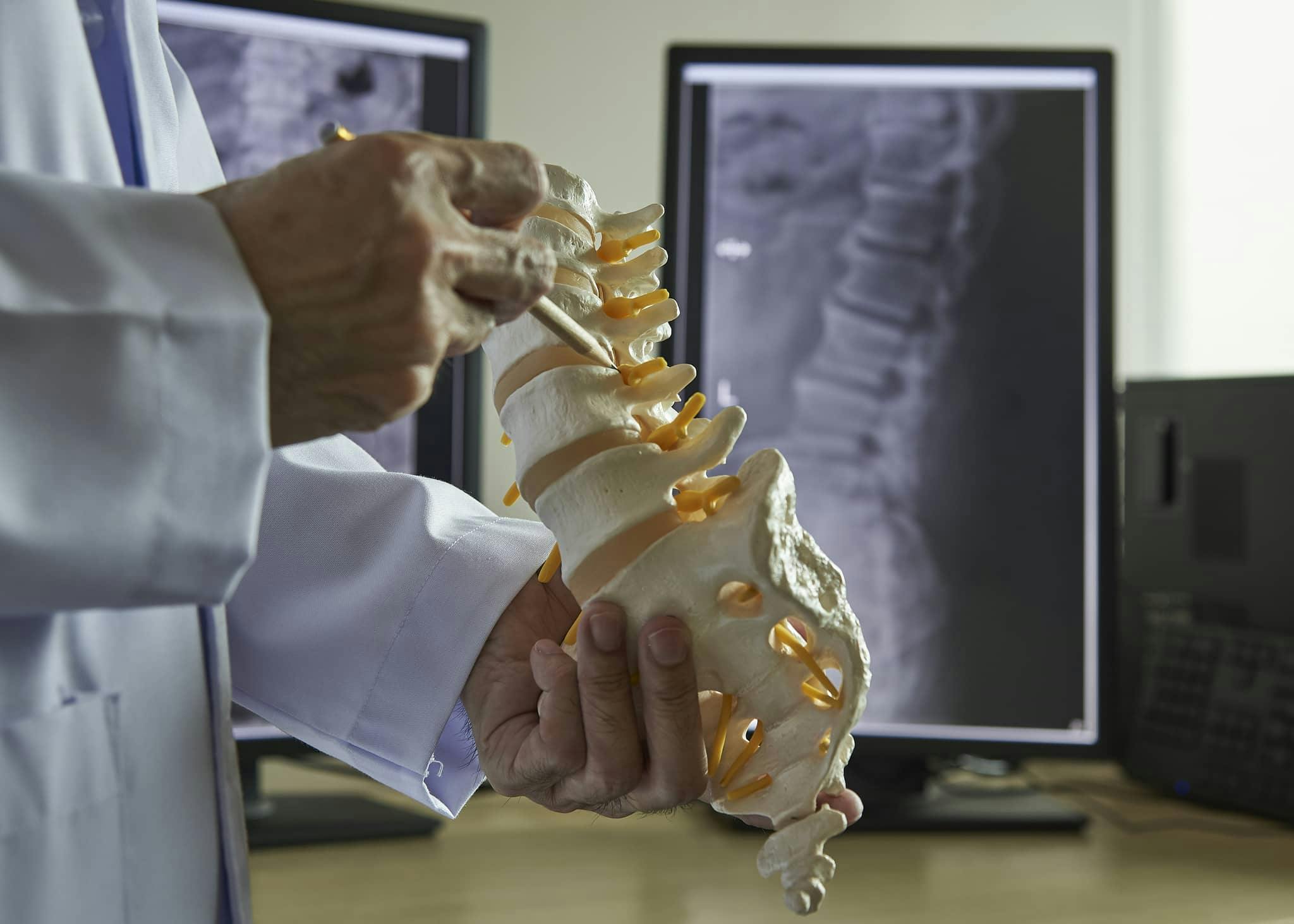 doctor holding model of human spine