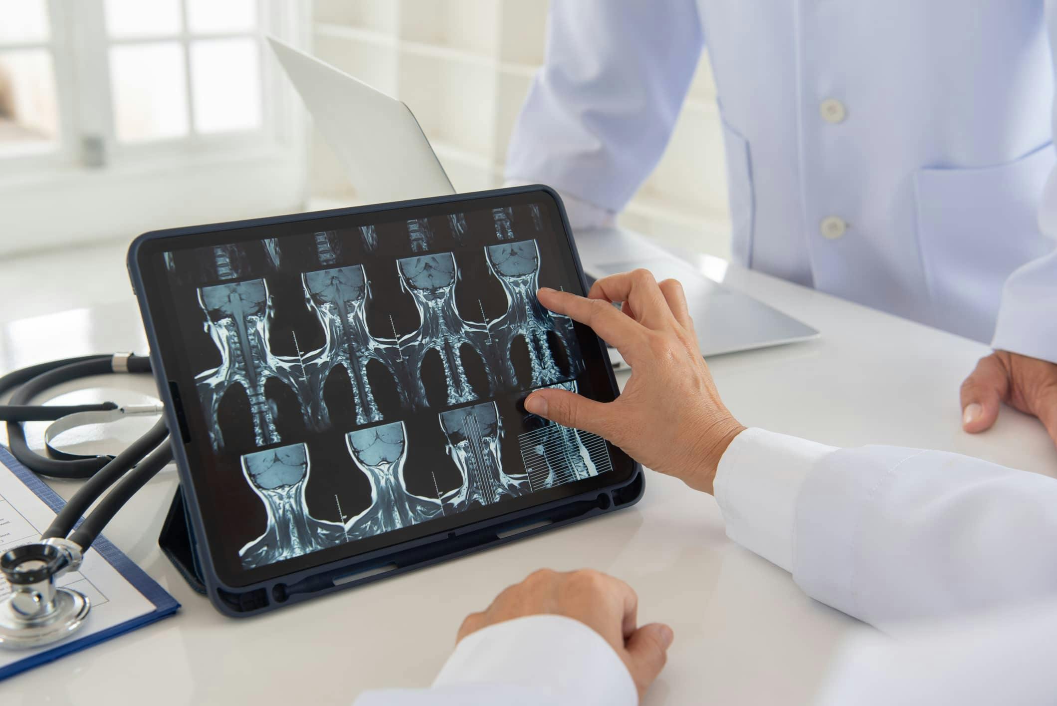 x-ray images of the spine on a tablet