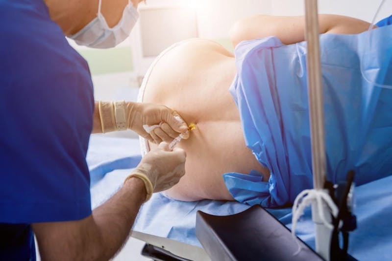 Everything You Need to Know About Epidural Injections for Chronic Back  Pain: Center for the Functional Restoration of the Spine: Orthopaedic Spine  Specialists