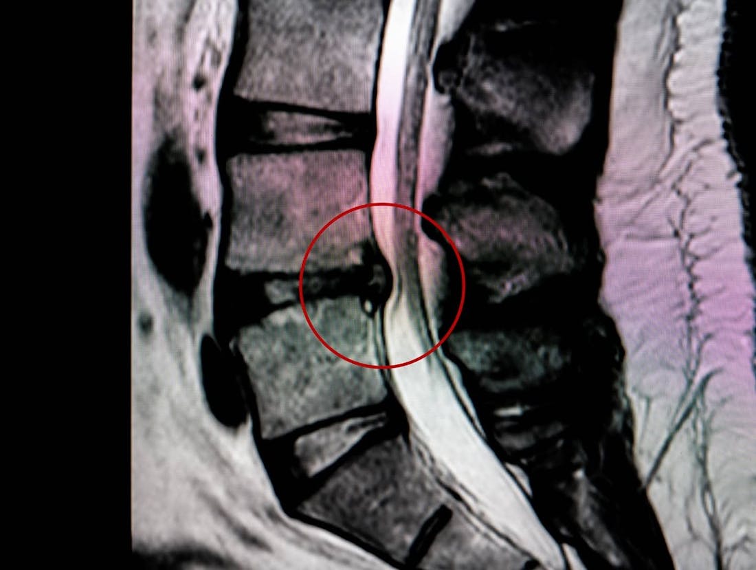 x-ray image of spine