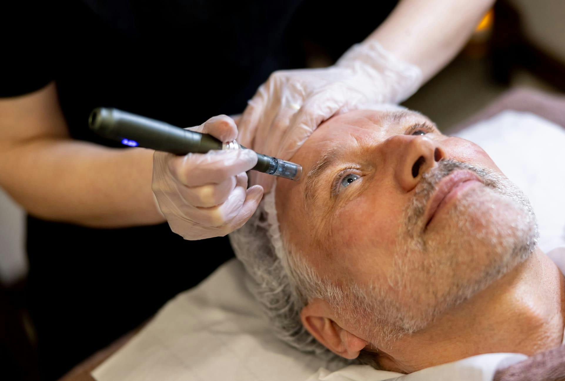 man getting microneedling done