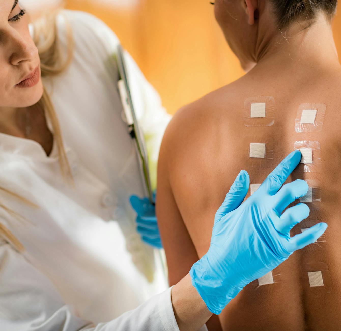 person undergoing allergy testing