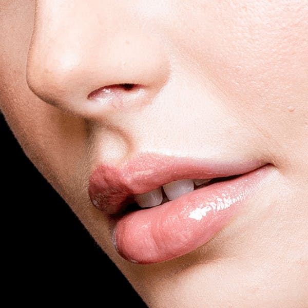 Why That ‘Needle-Free Filler’ You’re Seeing Online Is a Bad Idea