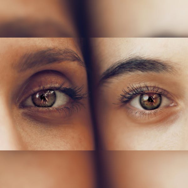 Experts Share the Latest Solutions for Chronic Under-Eye Bags