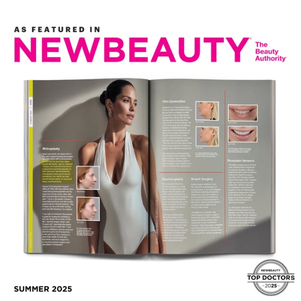 Dr. Klausner featured in NewBeauty: Article titled In Your Skin: Patients and Doctors Share Their Confidence-Boosting Procedures