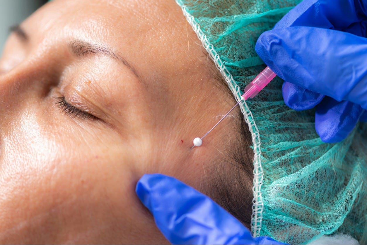Dr. Klausner featured in NewBeauty: Should You Get a Thread Lift? Doctors Debate