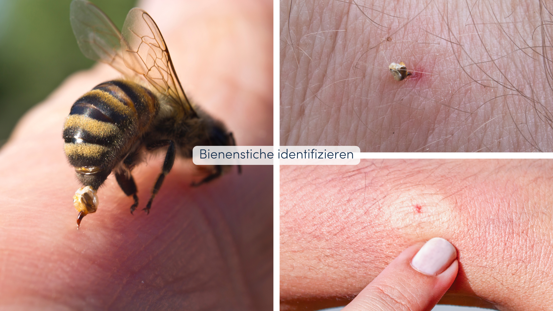Insektenstiche unterscheiden Bienenstiche identifizieren