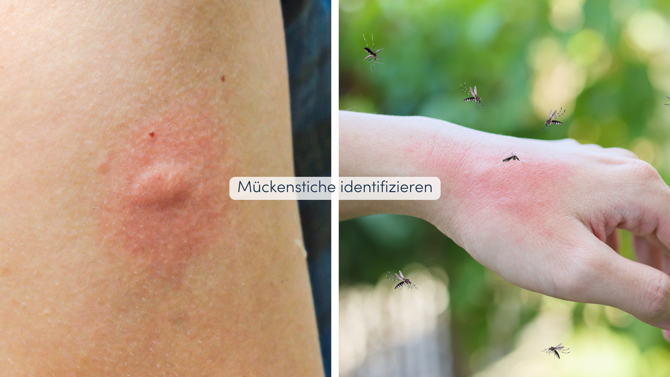 Insektenstiche unterscheiden Mückenstiche identifizieren