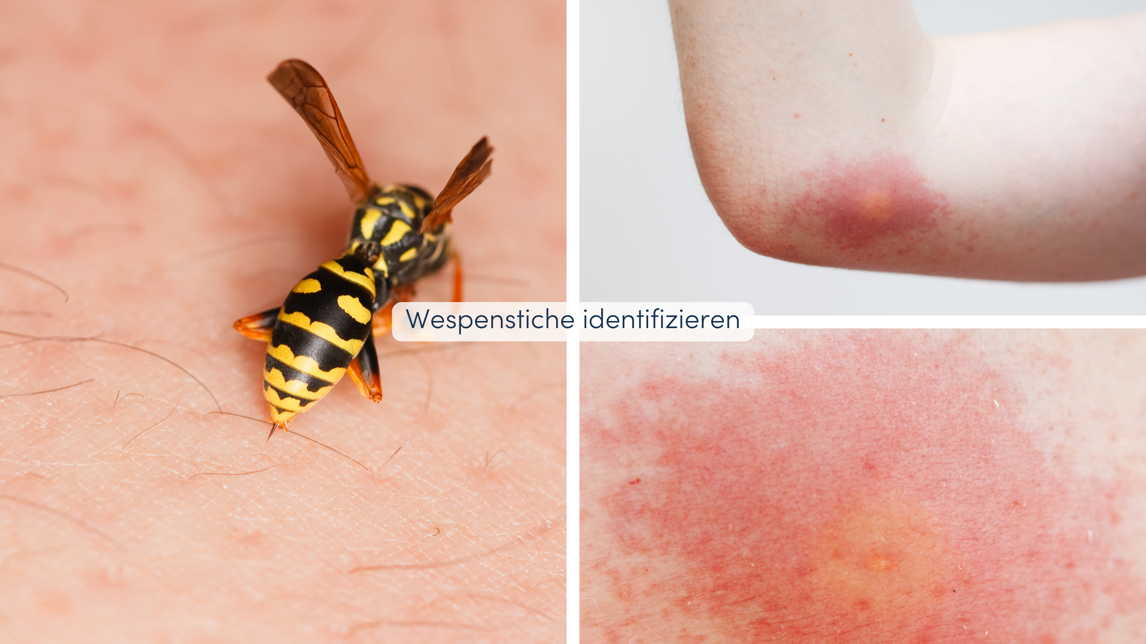 Insektenstiche unterscheiden Wespenstiche identifizieren