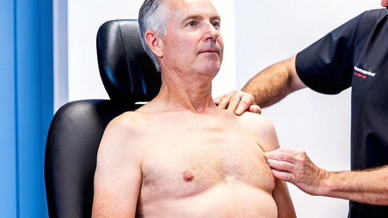 The Truth About Non-Surgical Gynecomastia Treatments - Do They Work Blog by Dr Michael Baumholtz